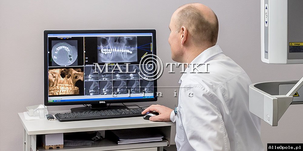 Dobry dentysta w Opolu - Stomatologia Malottki Clinic